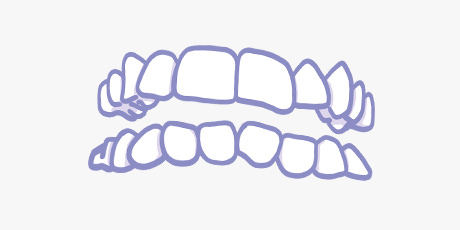 Clera / Dientes apiñados Clera / Dientes apiñados